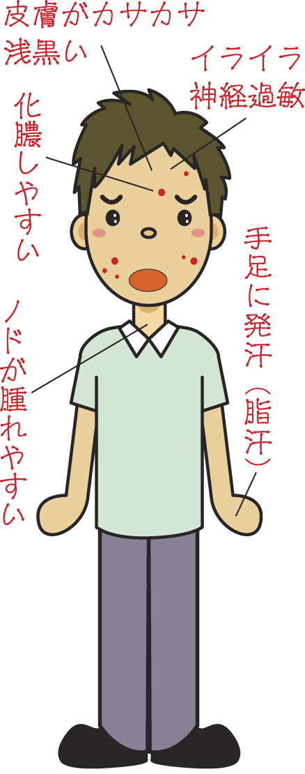 荊芥連翹湯適応症