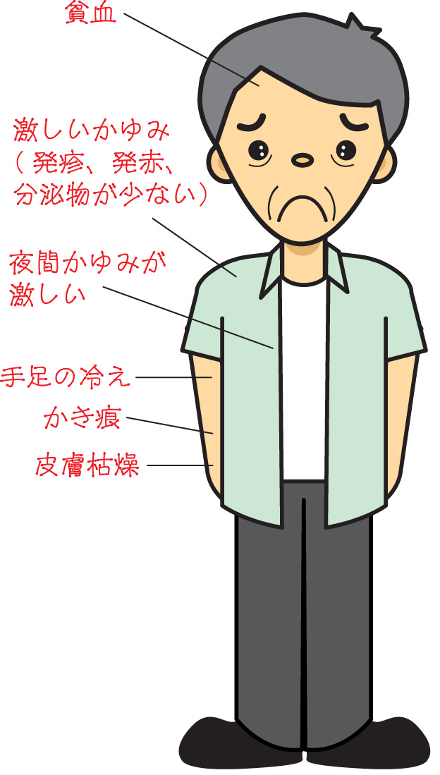 当帰飲子適応症